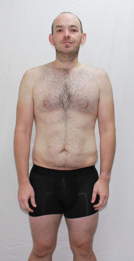Anthony after his transformation