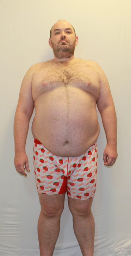 Anthony before his transformation
