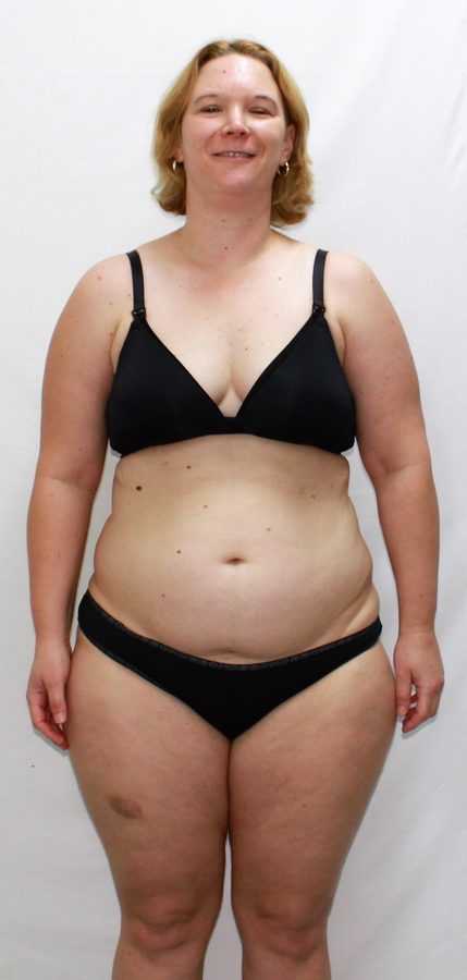 Client before her transformation