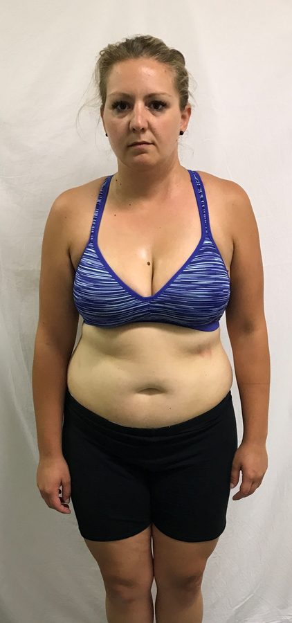 Client partway into her weight-loss journey
