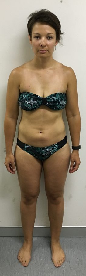 Client before her transformation